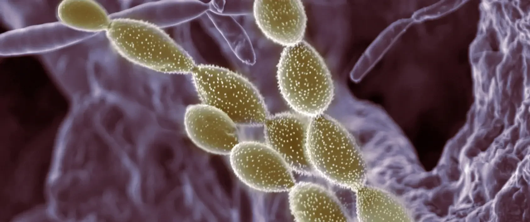 Electron microscope image of soil microbes forming a chain structure. Captured by Alice Dohnalkova, distributed under CC BY 3.0 via imaggeo.egu.eu.